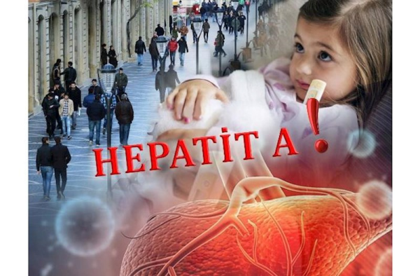 5-14 yaş qrupu uşaqlar Hepatit A virusuna daha çox yoluxur